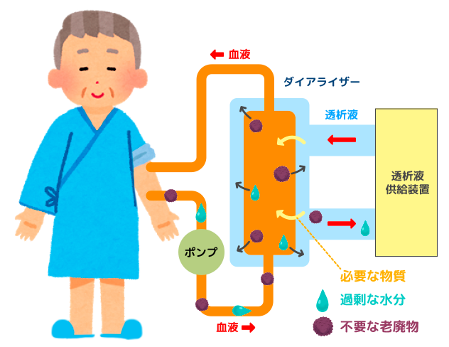 透析治療は、排泄されない状態から老廃物や余分な水分を除去していく『代替治療』です。