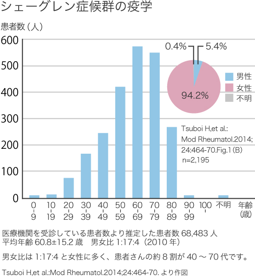 症候群 症状 シェーグレン