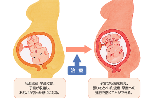 よりよい出産をむかえるために キッセイ薬品工業株式会社