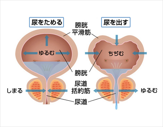 出す 方法 シッコ お