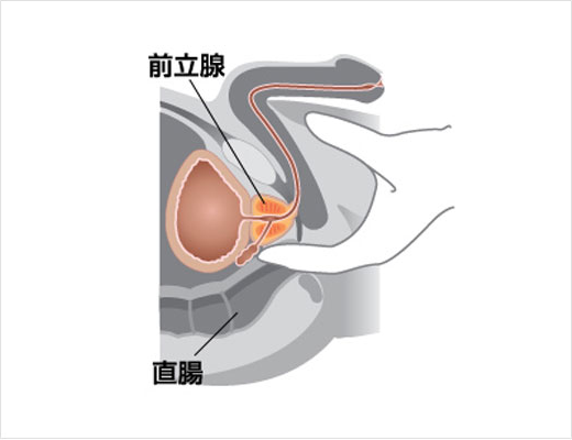 鉄欠乏性貧血勃起不全